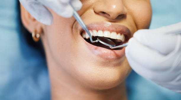Best Emergency Dental Care for Broken or Chipped Teeth in Juneau, WI